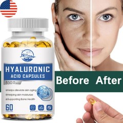 Hyaluronic Acid with & Vitamin C | 850 mg | 60/120/240 Capsules | Non-GMO